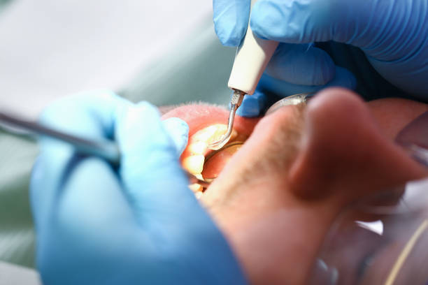 Best Same-Day Emergency Dentist in Pearl Beach, MI