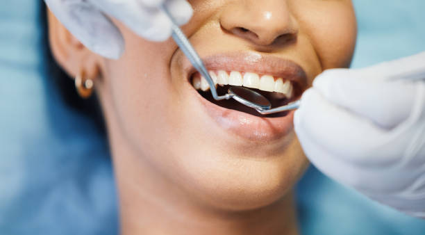 Best Emergency Treatment for Toothache in Pearl Beach, MI
