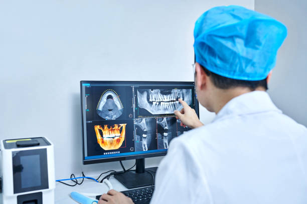 Best Emergency Tooth Extraction in Pearl Beach, MI